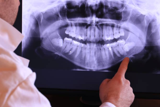 Best Broken Tooth Emergency  in Luna Pier, MI